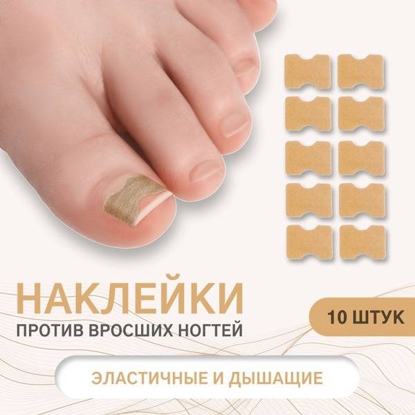 Ingrown Toenail Stickers (10 Pack, Brown)
