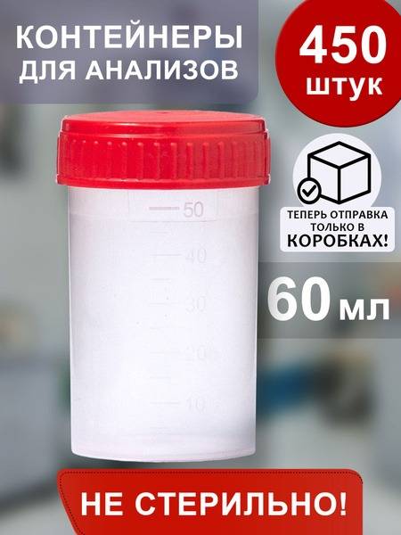 Non-Sterile 60ml Sample Containers (450-Pack)