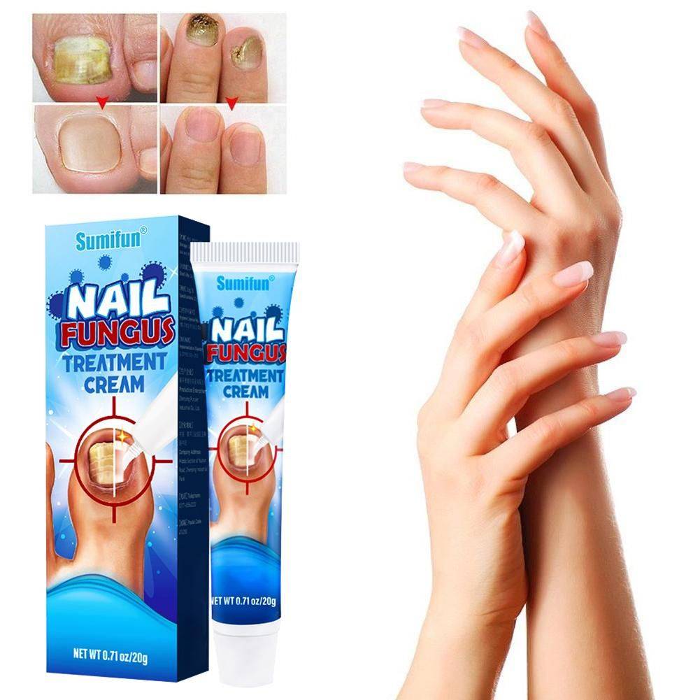 Sumifun Nail Fungus Cream 20 g #6
