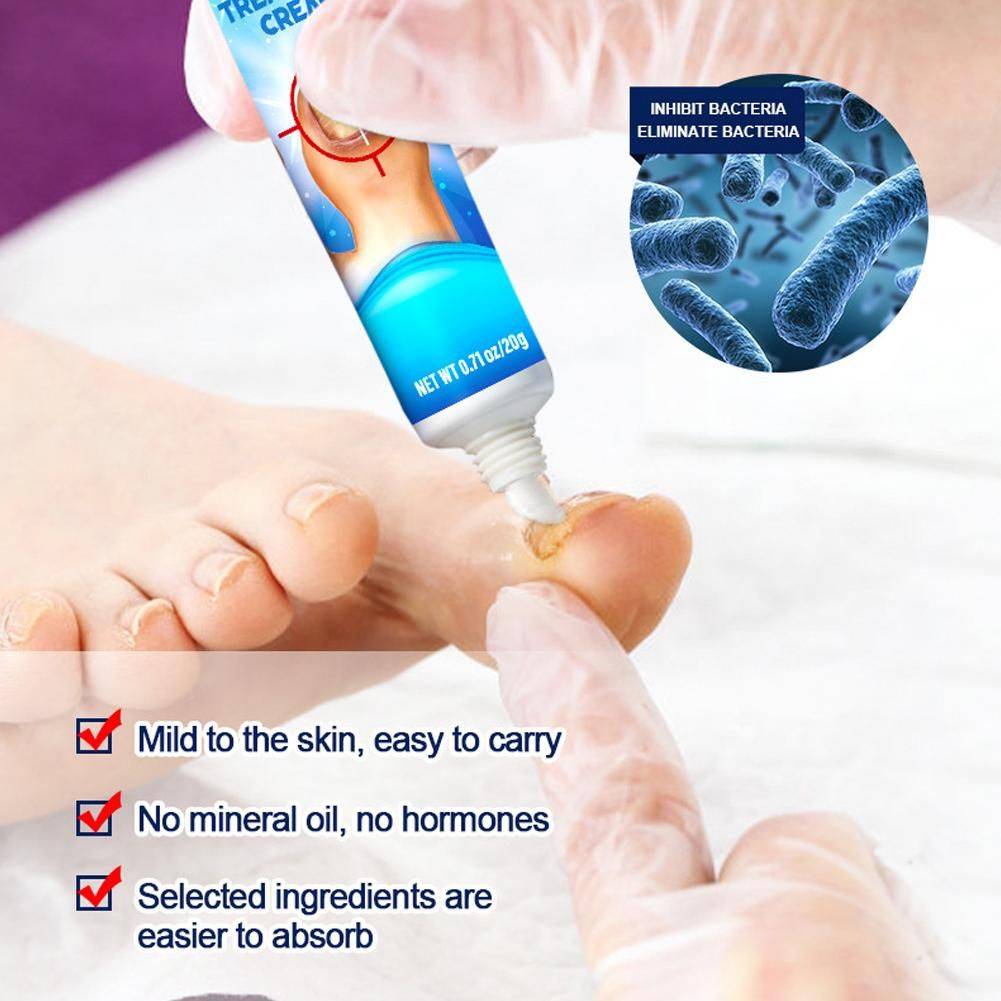 Sumifun Nail Fungus Cream 20 g #13