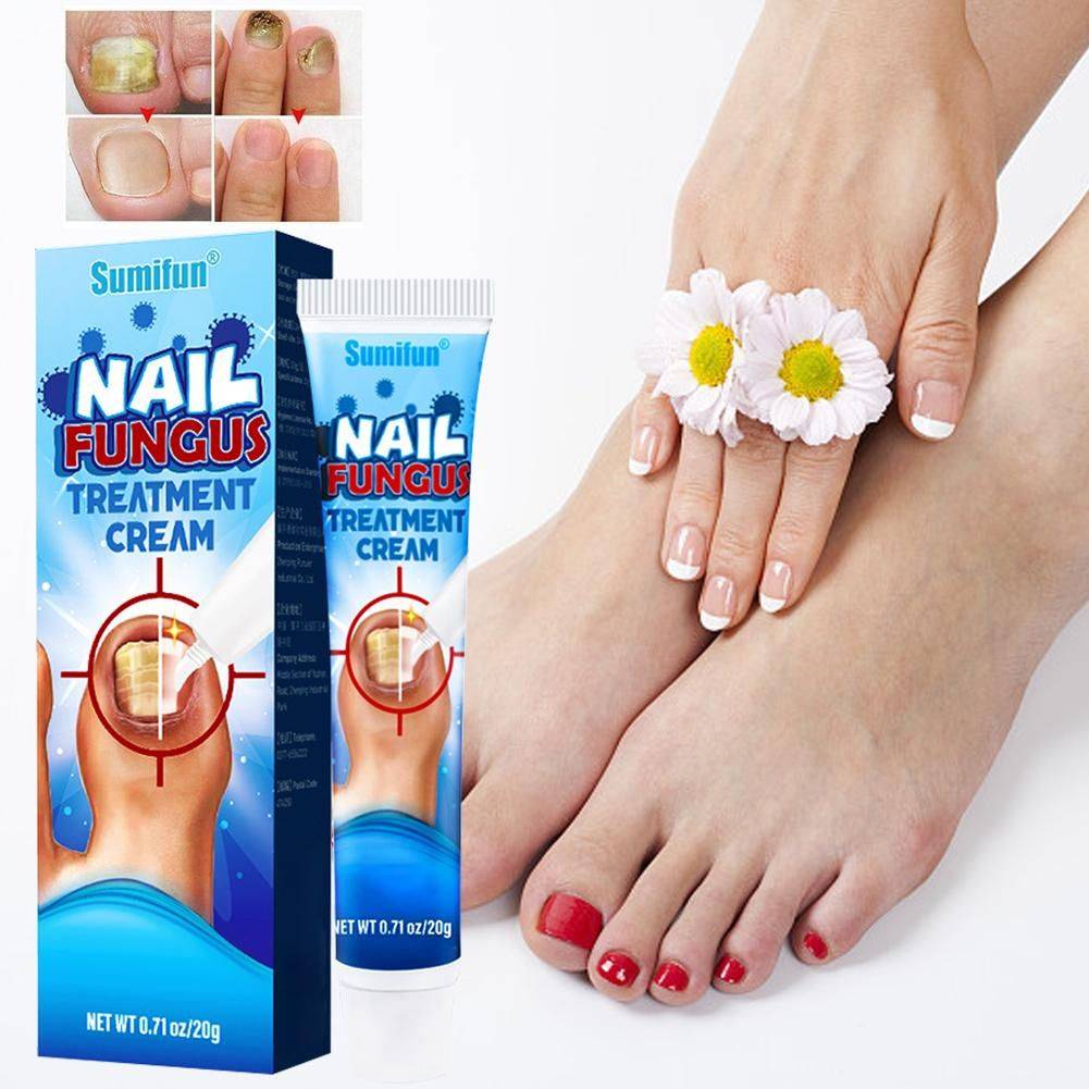 Sumifun Nail Fungus Cream 20 g #7