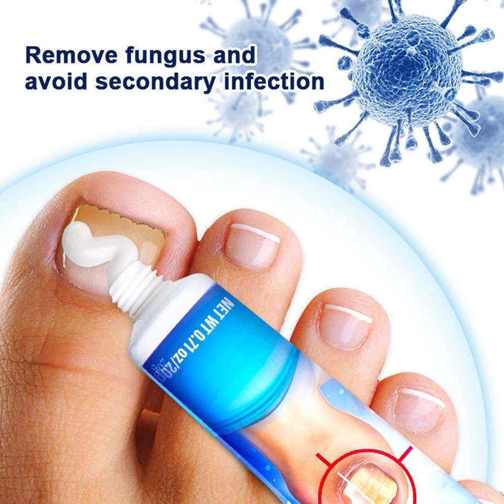 Sumifun Nail Fungus Cream 20 g #11