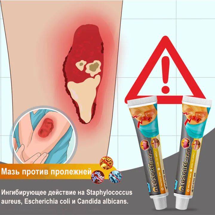 Bed Sore Treatment Cream for Healing Skin Injuries – 20g #8