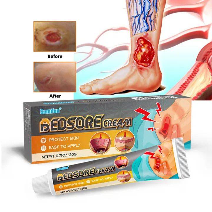 Bed Sore Treatment Cream for Healing Skin Injuries – 20g #3