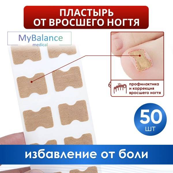 MyBalance Foot Corrector Patch for Ingrown Toenail – 50 pcs Beige