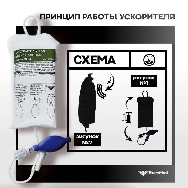 SURV24 USKINF-SM-05pv Intravenous Infusion Accelerator, 500 ml, 1 Unit