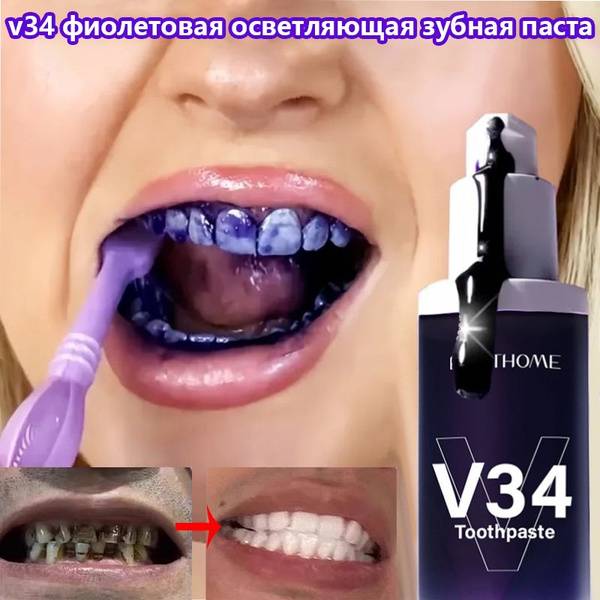 Purple Whitening Toothpaste (30ml): Removes Stains, Freshens Breath