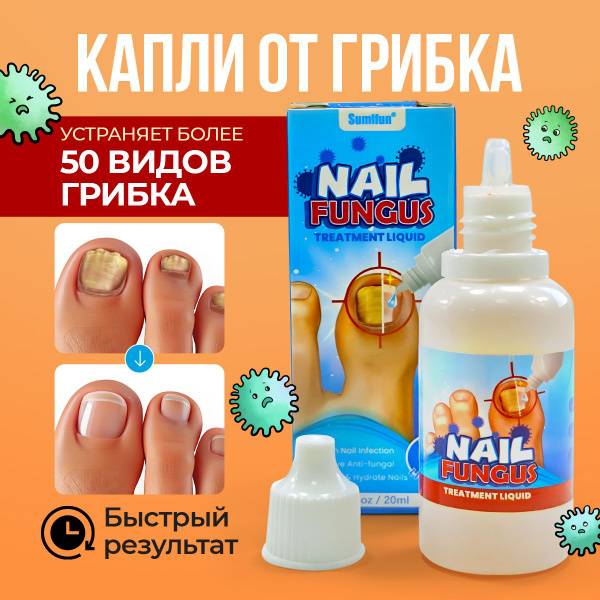 Sumifun Nail Fungus Drops, 30 ml, 1 Pack