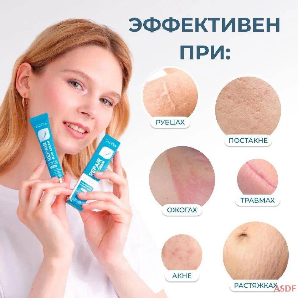 Sadoer Scar and Skin Recovery Cream 20g #4