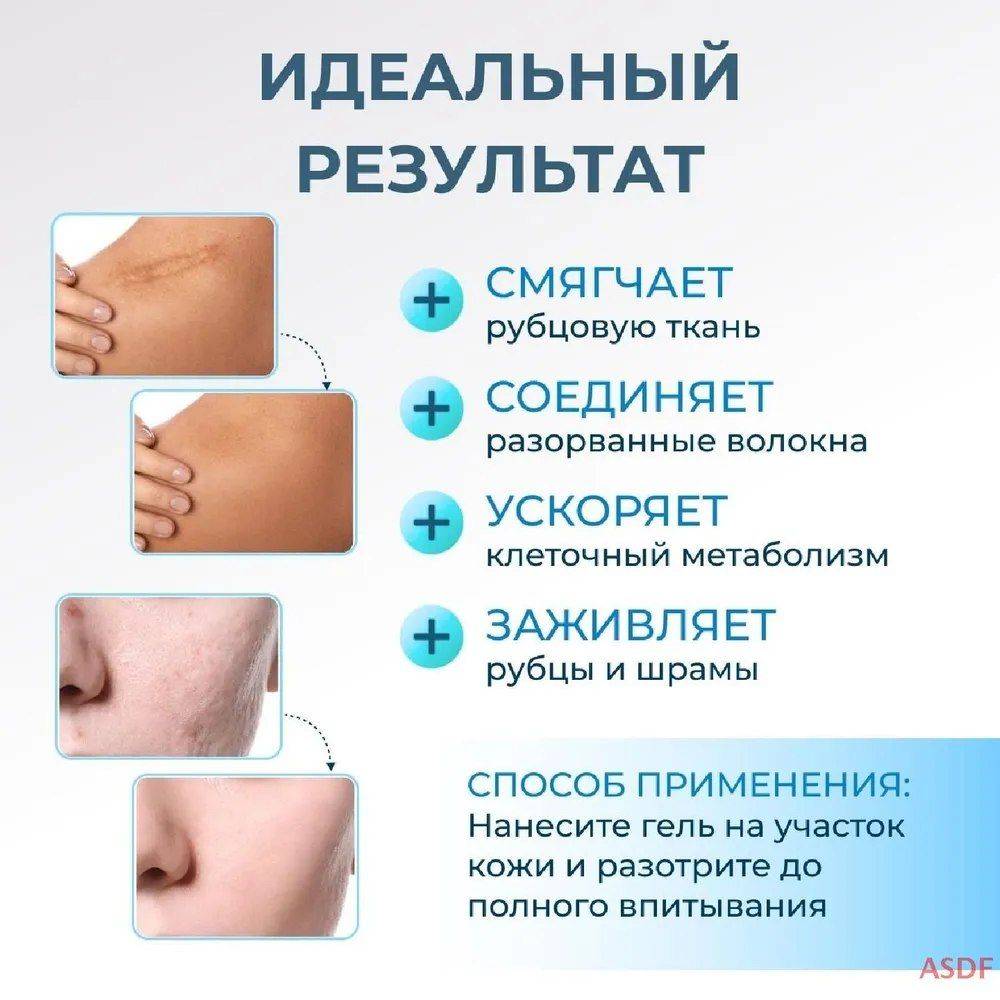 Sadoer Scar and Skin Recovery Cream 20g #5