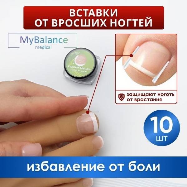 MyBalance Ingrown Toenail Corrector Inserts, 10 Pack, Transparent