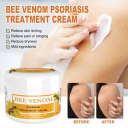 Myriade Psoriasis Cream with Bee Venom – 38 g #1