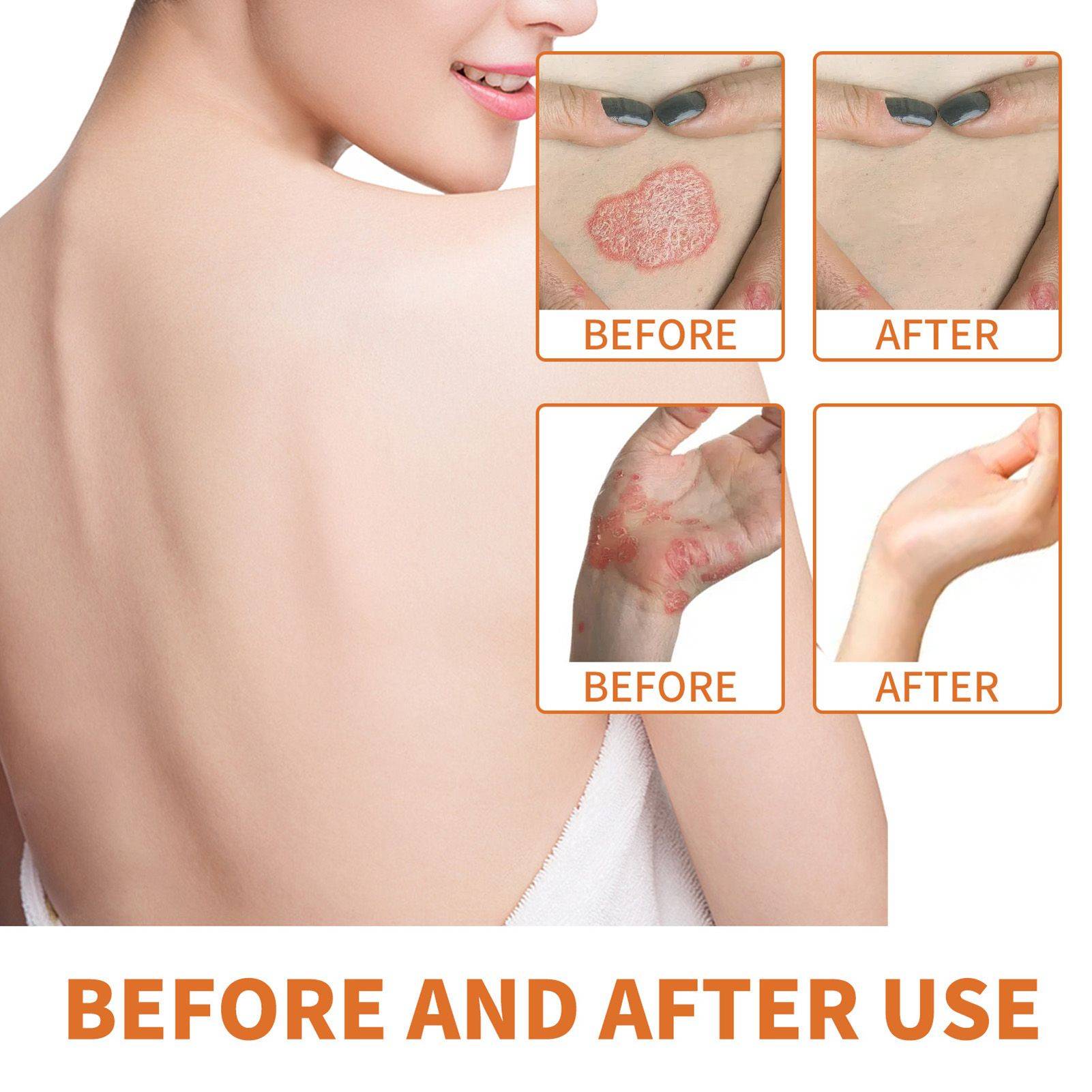 Myriade Psoriasis Cream with Bee Venom – 38 g #9