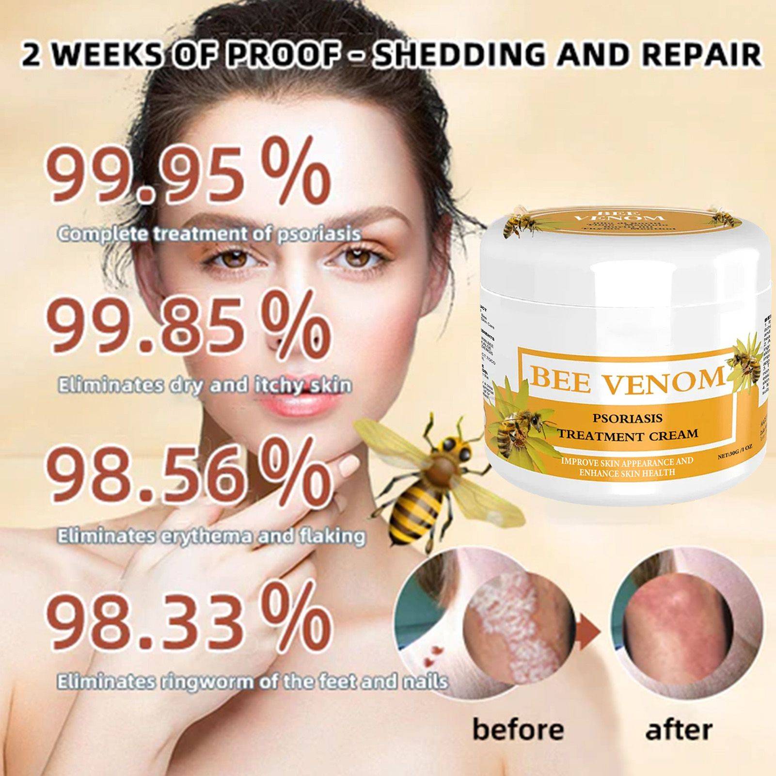 Myriade Psoriasis Cream with Bee Venom – 38 g #8