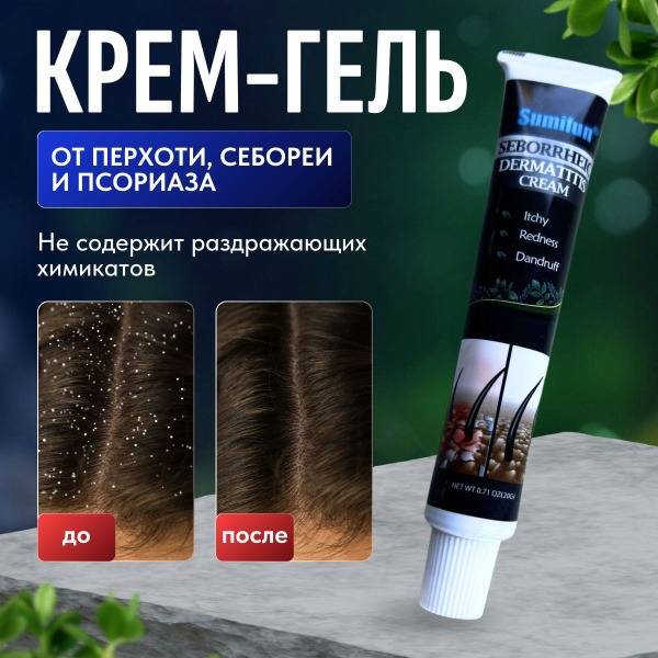 Scalp Cream Gel: Anti-Dandruff, Anti-Itch, Psoriasis Relief