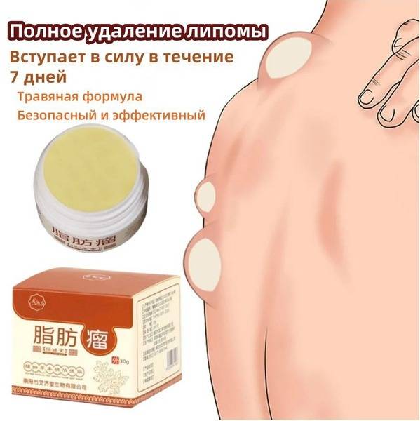 Body Cream: Reduce Cellulite & Fat