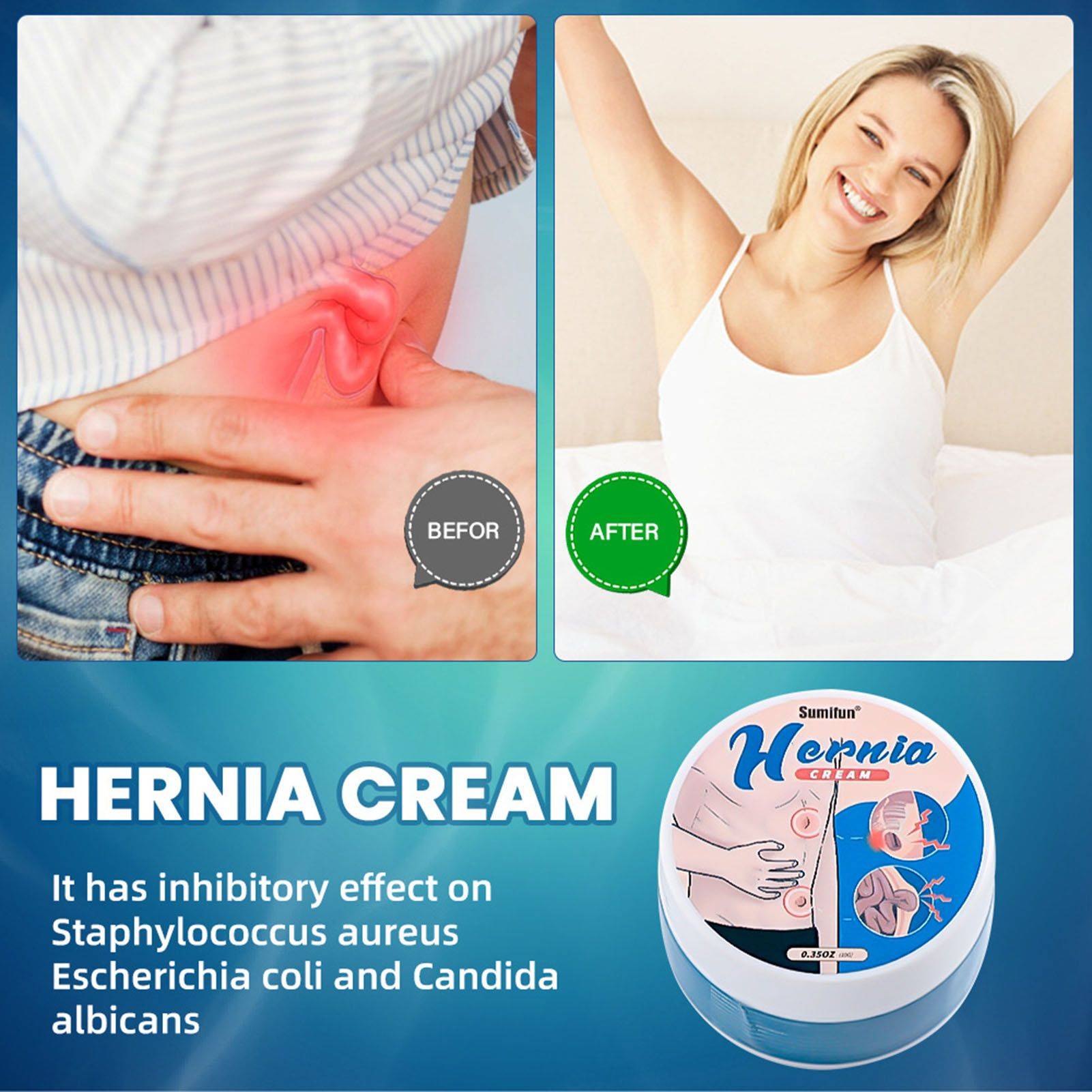 Herbal Hernia Ointment for Inguinal Swelling Relief, 10g #3
