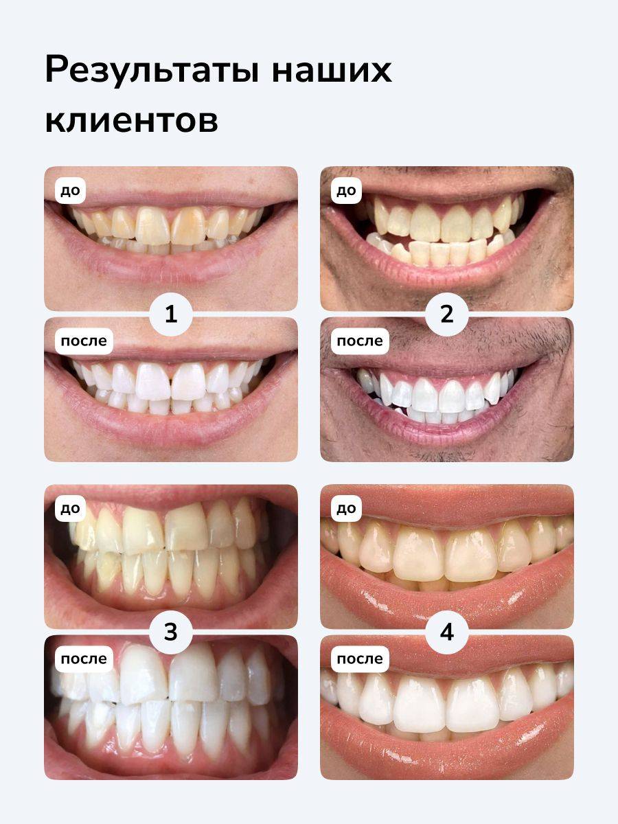 Smilebe by Toplash Whitening Toothpaste for Sensitive Teeth PAP+ 40 ml 2-Pack #4