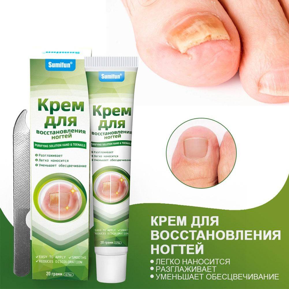 Colloidal Silver Nail Fungus Cream 20 ml