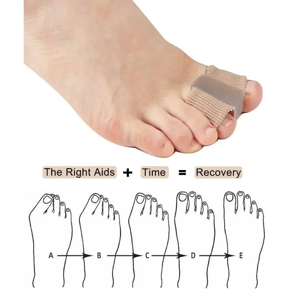 2-Pack Hallux Valgus Corrector with Toe Spacers #7