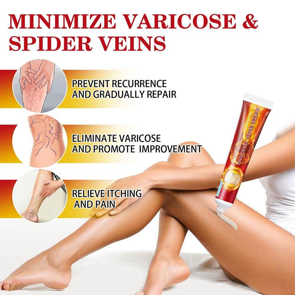 Wellness Life Chinese Cream Ointment for Varicose Veins, 20 g #8