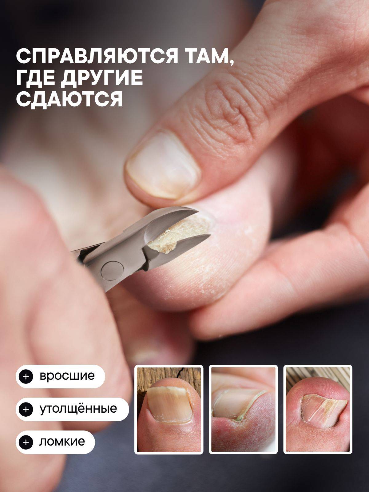 Professional Stainless Steel Toenail Clippers for Thick and Problematic Nails - by TM #2