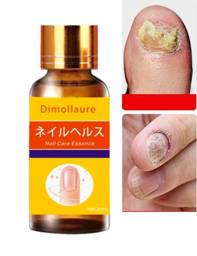 Dimollaure Strong Nail Fungus Essence 30ml #1