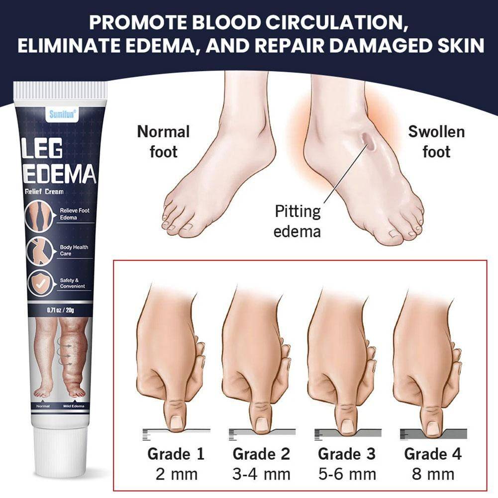 FOLLNSI Blue Ointment for Leg Swelling Relief #8