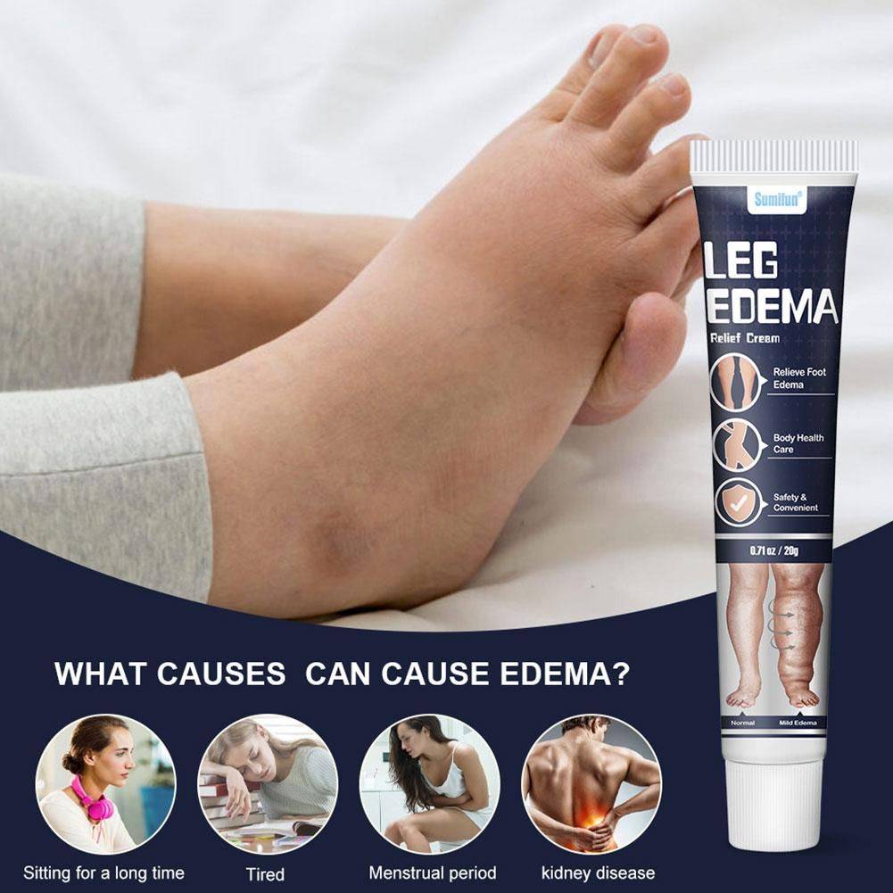 FOLLNSI Blue Ointment for Leg Swelling Relief #4