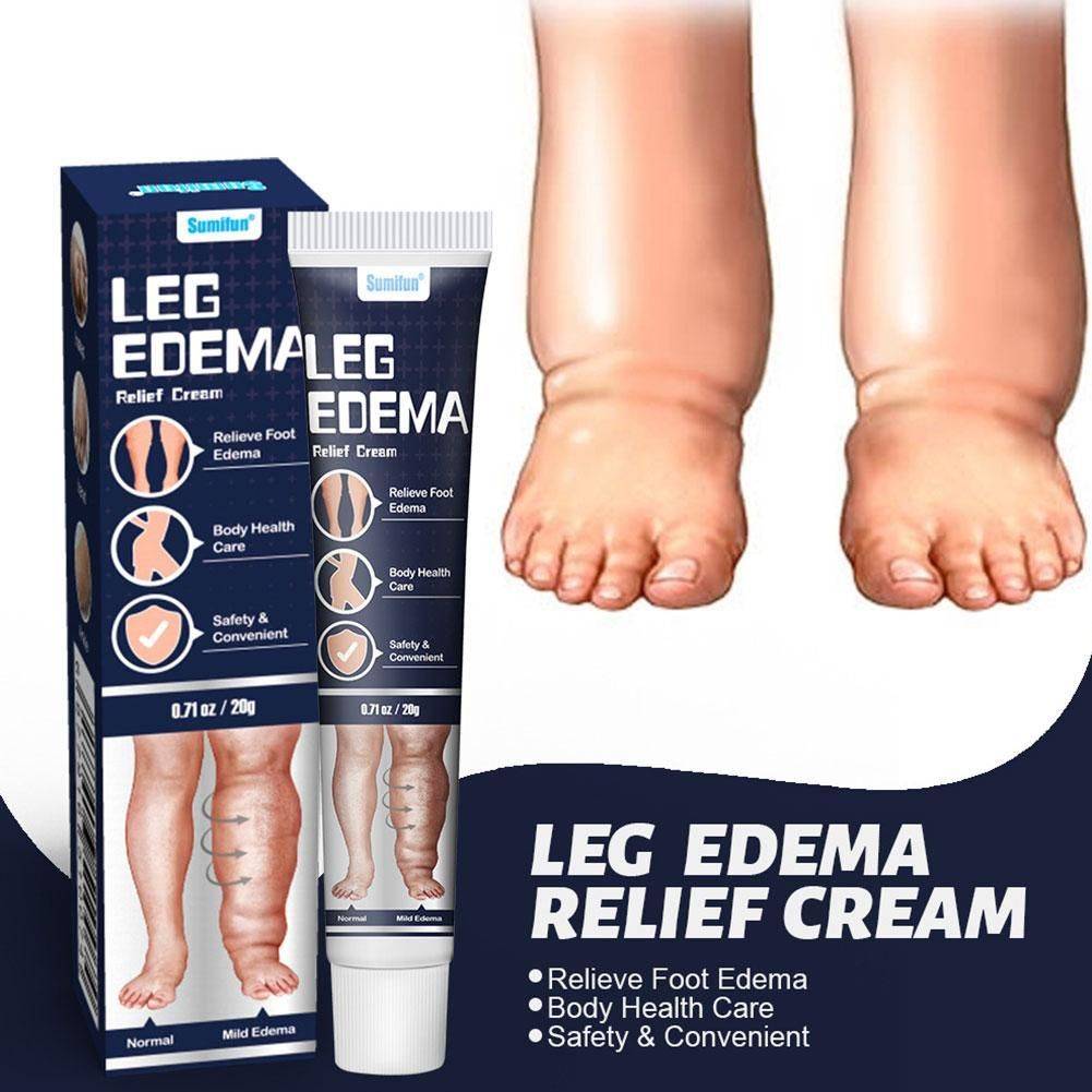 FOLLNSI Blue Ointment for Leg Swelling Relief #2