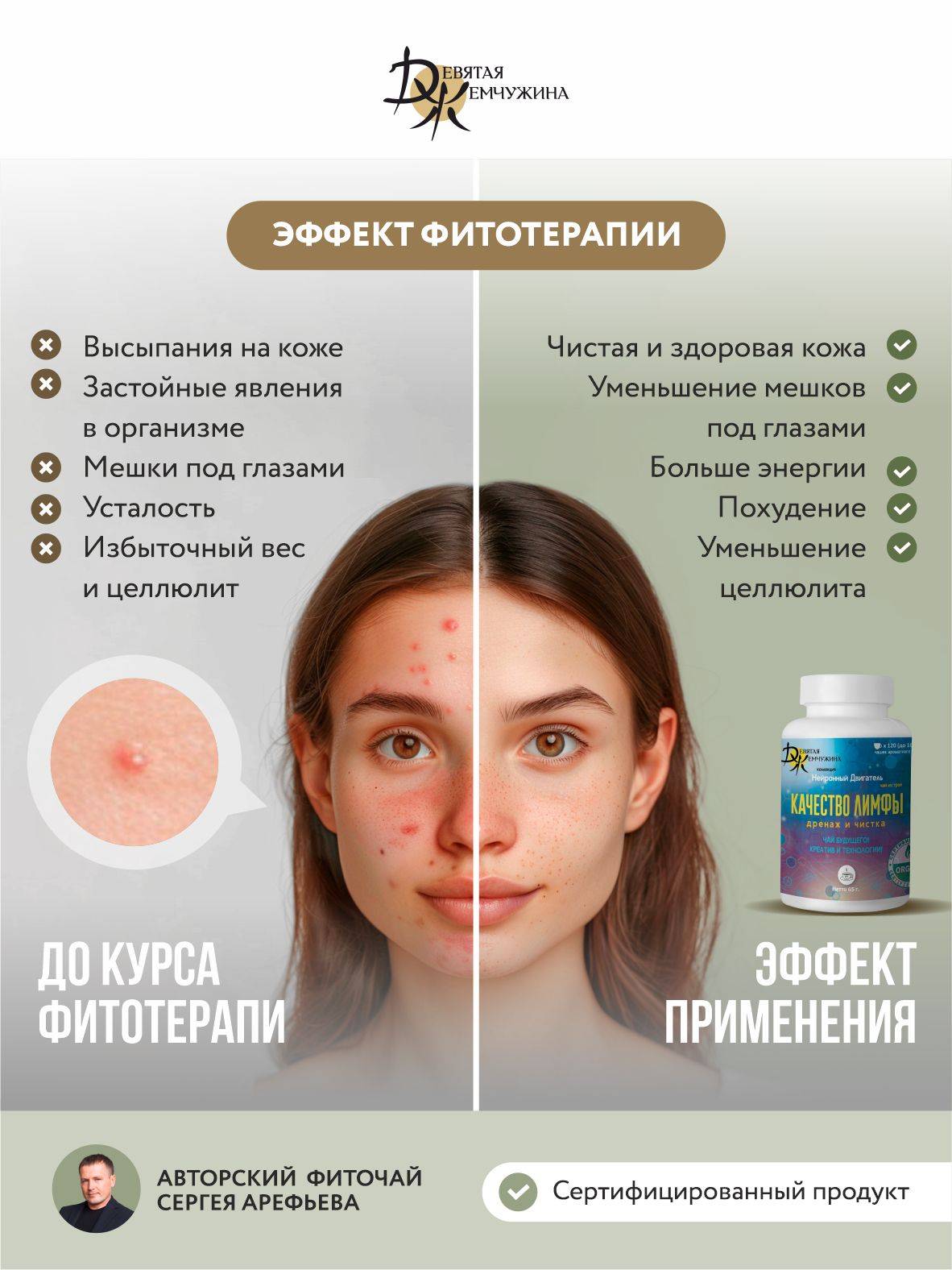 Lympodrenazhnyy Chay for Body and Lymph Cleansing, Lymphatic Drainage from Swelling, Devyataya Zhemchuzhina #3