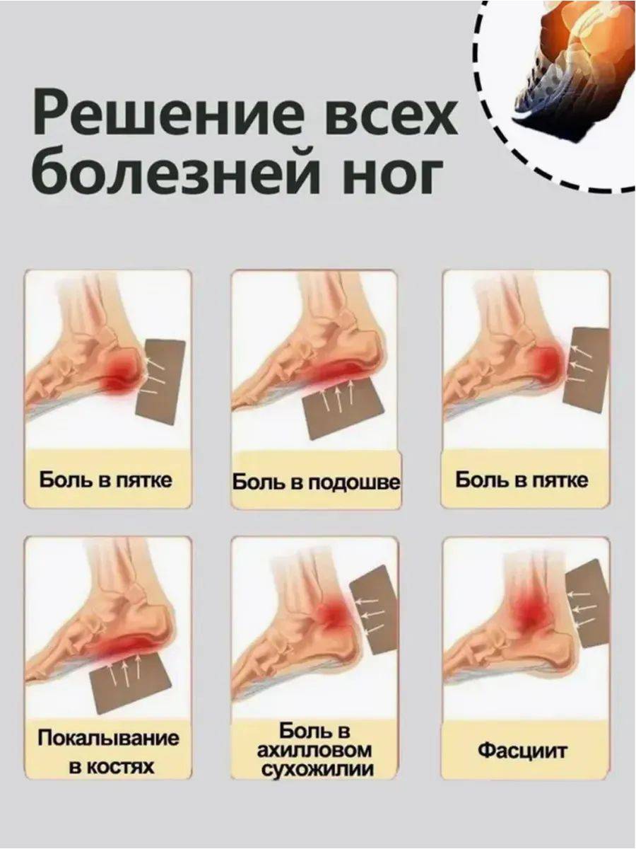 Heel Pain Relief Patches for Plantar Fasciitis & Heel Spurs, 12 Count #6