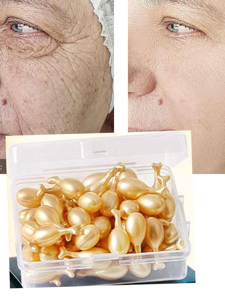 Dimollaure Anti-Aging 3.19 ml