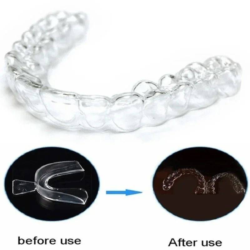 Silicone Night Guard – 2 Pairs Soft Transparent (63 mm) #9