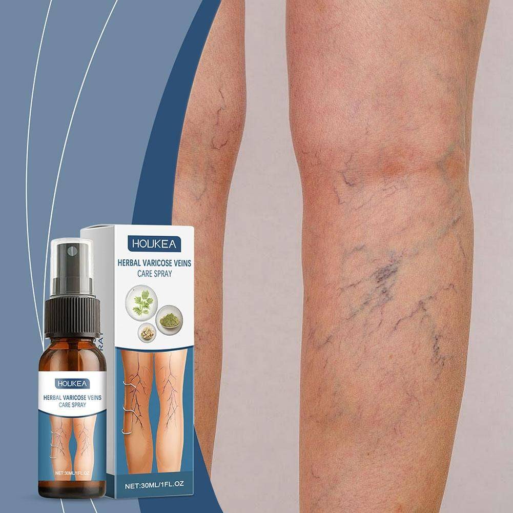 Varicose Vein & Spider Vein Relief Spray, 30ml #5
