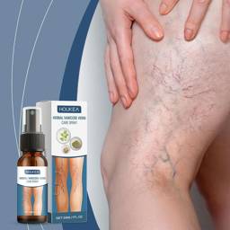 Varicose Vein & Spider Vein Relief Spray, 30ml #1