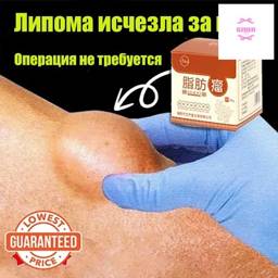 Cream for Subcutaneous Swellings - 20ml, for Skin Edema, Cellulite, and Fibroadipose Tumors #1