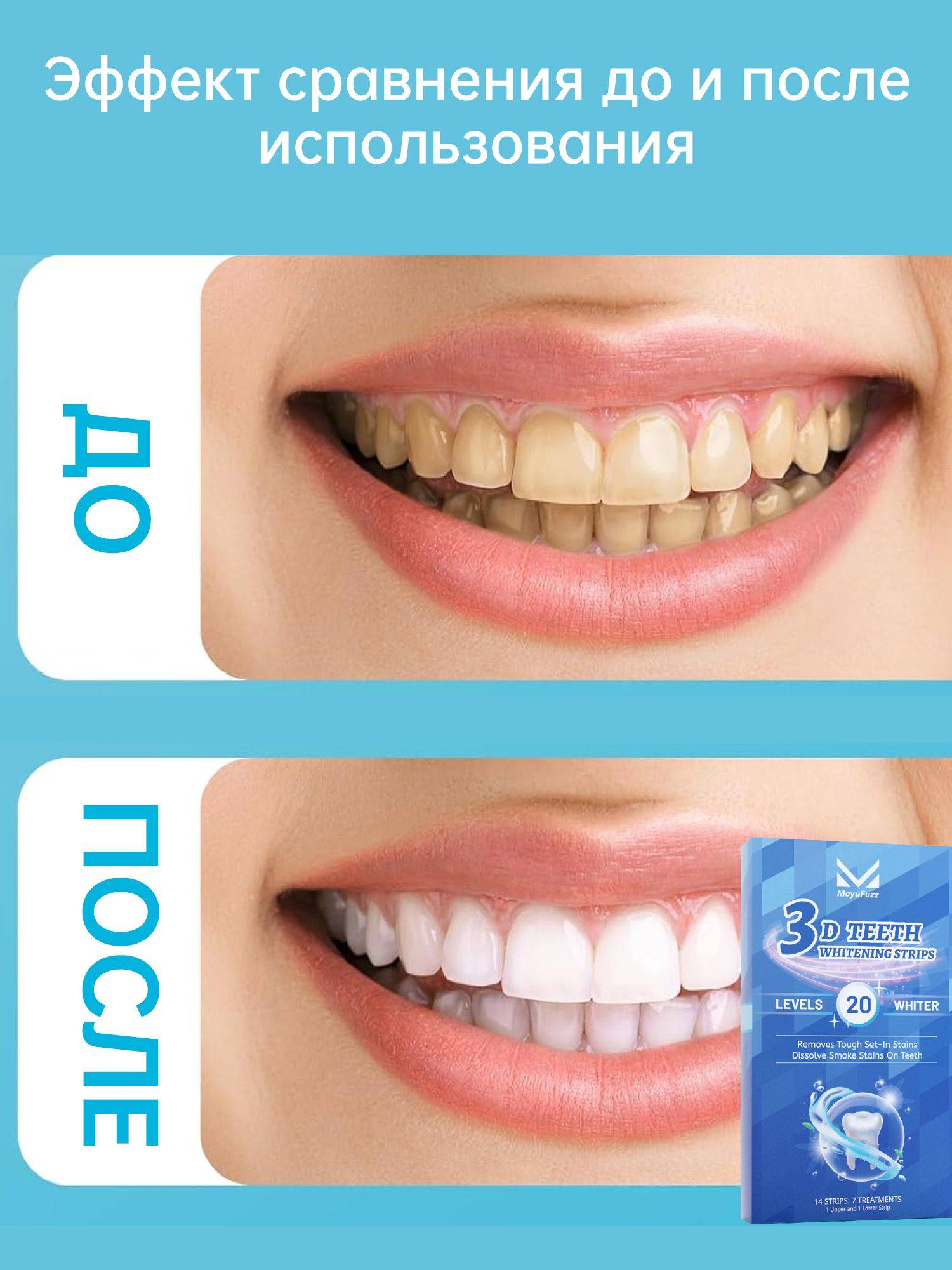 Mayufuzz Teeth Whitening Kit – 7 Pairs, Safe for Enamel, Removes Coffee, Tea & Smoke Stains #4