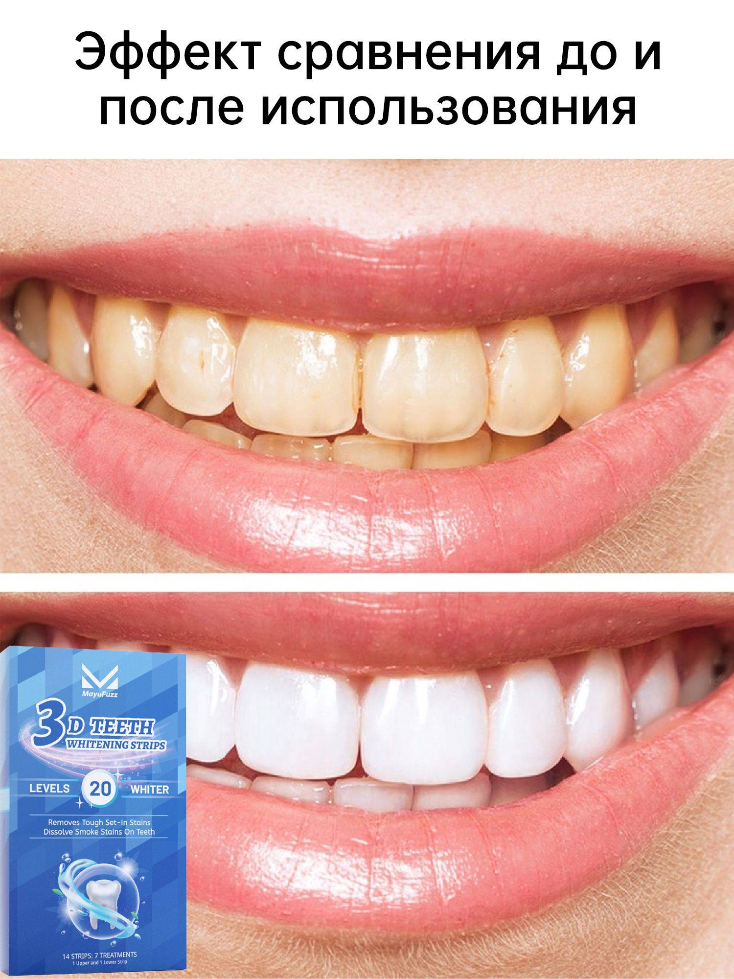 Mayufuzz Teeth Whitening Kit – 7 Pairs, Safe for Enamel, Removes Coffee, Tea & Smoke Stains #3