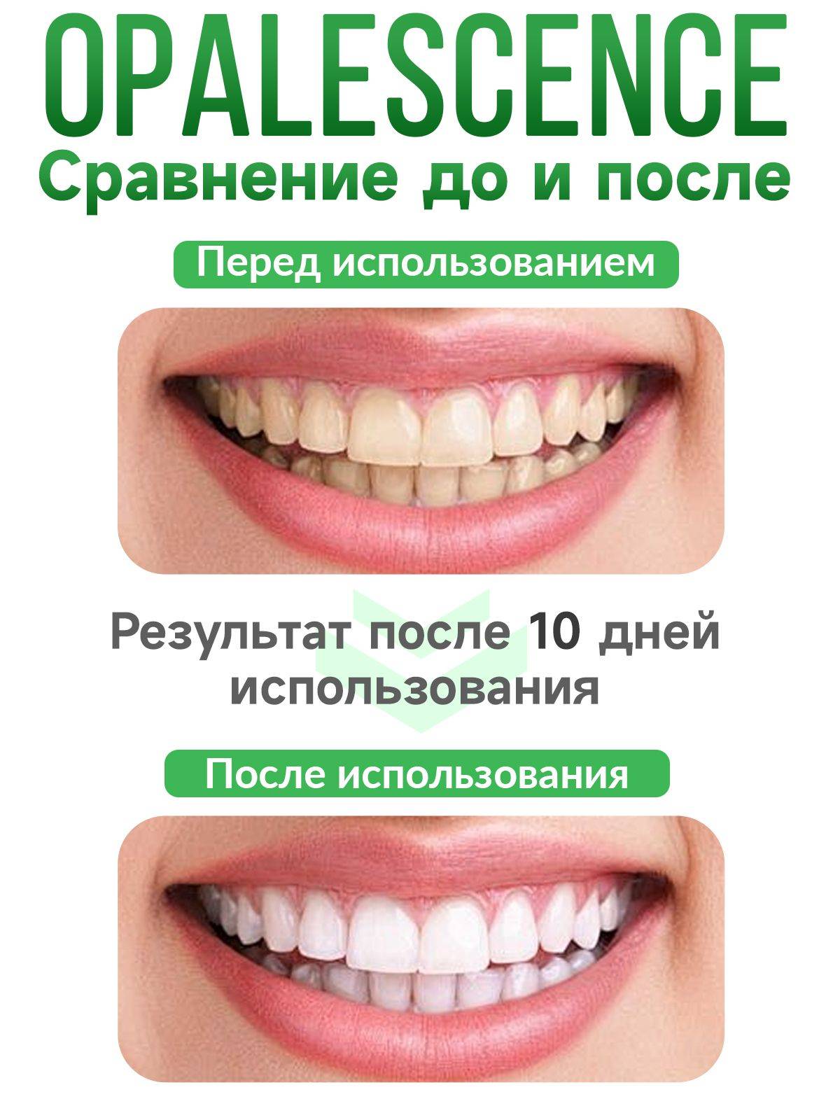 Opalescence Go 3% Home Teeth Whitening Kit (10 Trays) with Mint Flavored Gel - Gluten-Free, Kosher, Low Sensitivity | Ultradent, USA #5