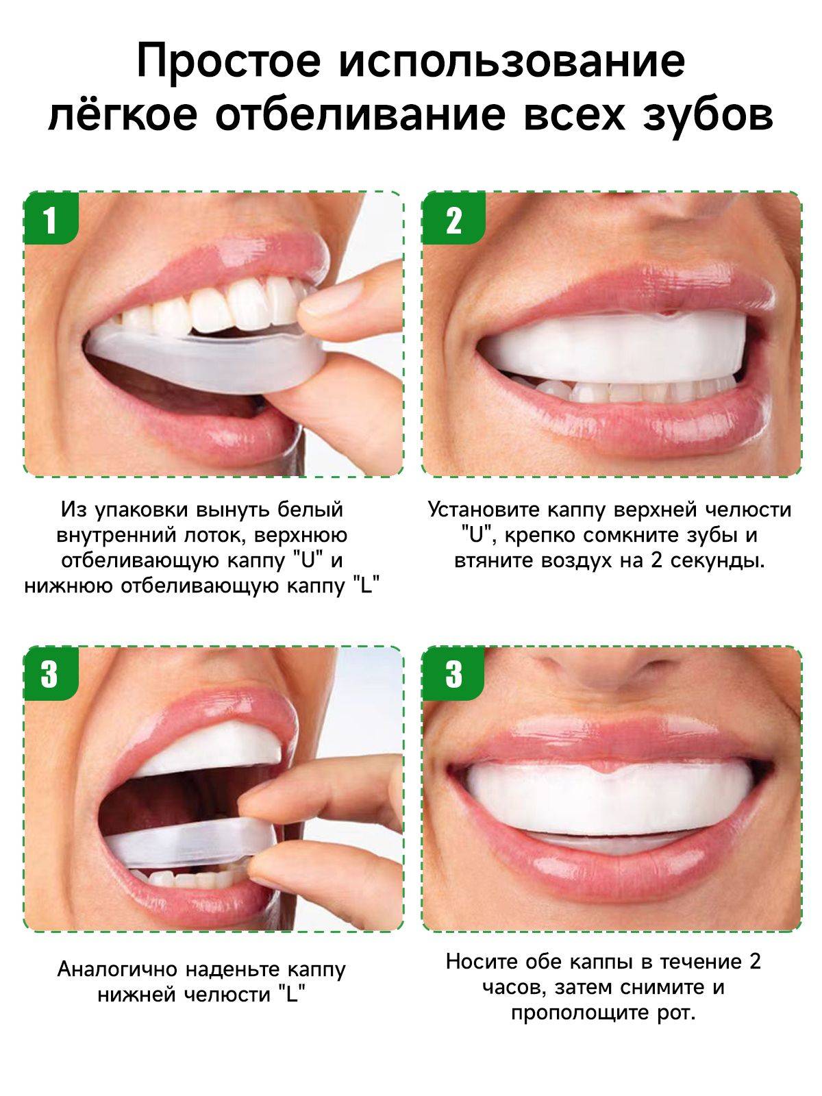 Opalescence Go 3% Home Teeth Whitening Kit (10 Trays) with Mint Flavored Gel - Gluten-Free, Kosher, Low Sensitivity | Ultradent, USA #3