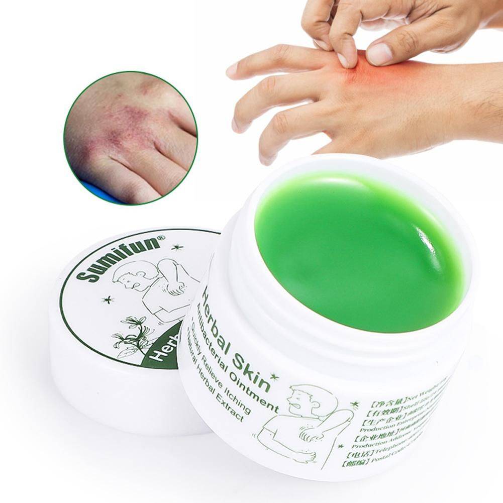 Histamine-Allergoderm Cream for Itching, Flaking, Allergic Dermatitis, and Insect Bites – 20g #10