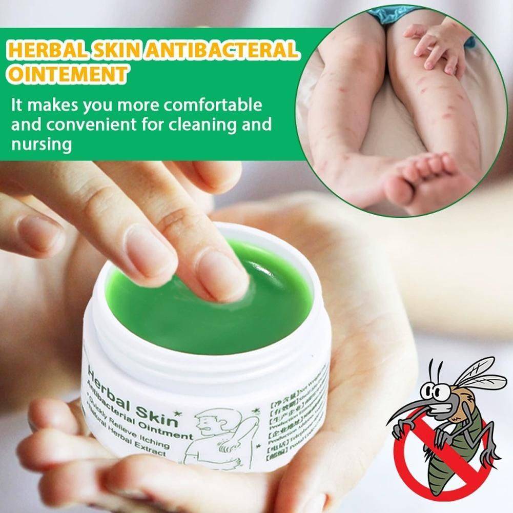 Histamine-Allergoderm Cream for Itching, Flaking, Allergic Dermatitis, and Insect Bites – 20g #3