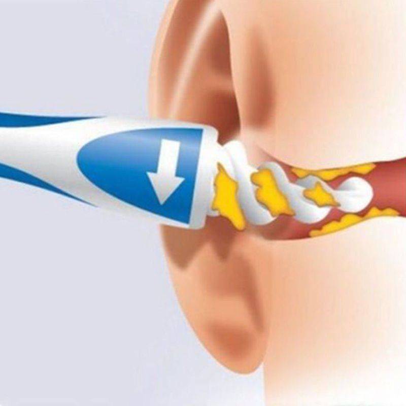 Ear and Nose Cleaning Tool #3