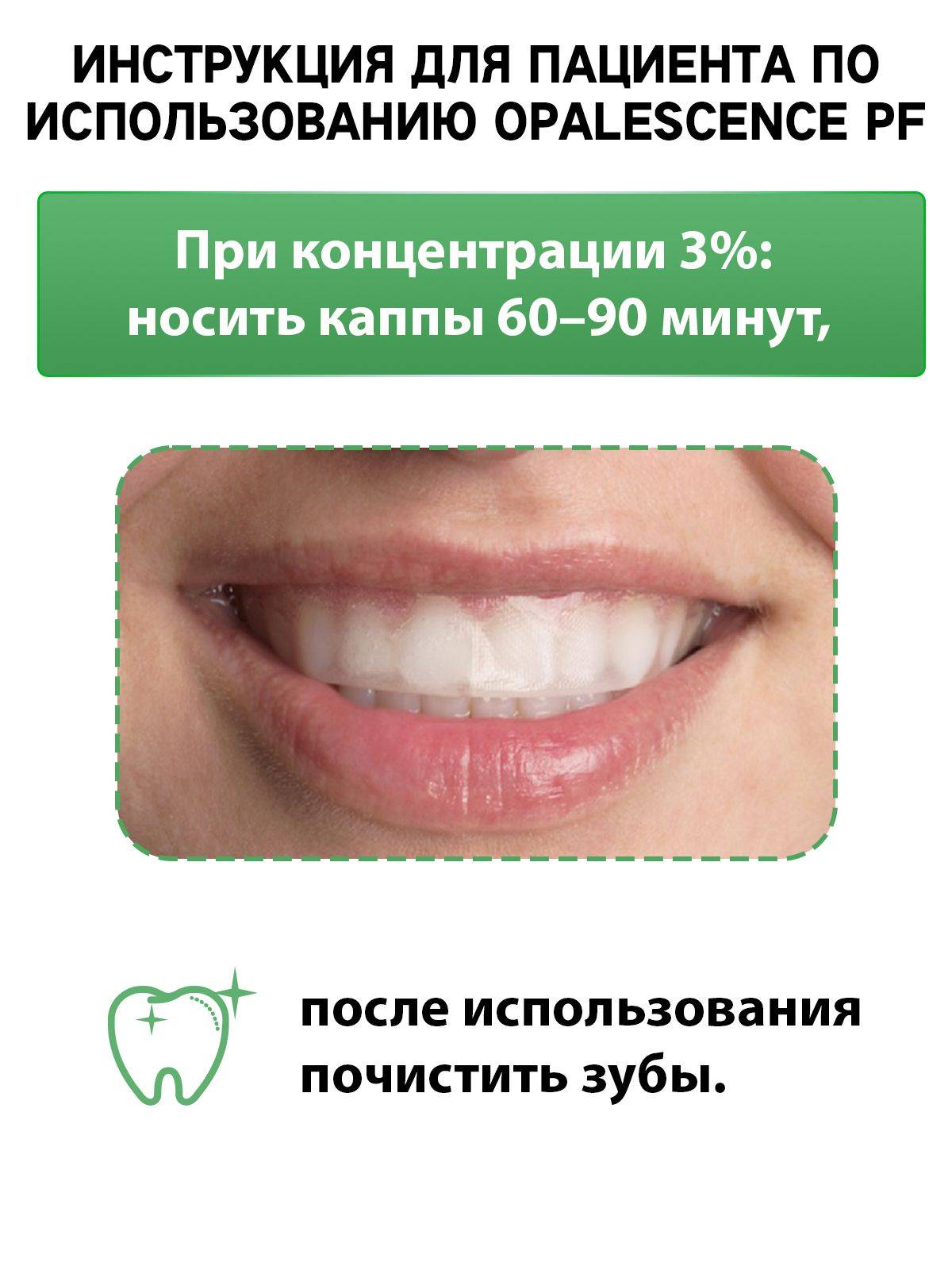 Opalescence Go 3% Home Teeth Whitening Kit (10 Trays) with Mint Flavored Gel - Gluten-Free, Kosher, Low Sensitivity | Ultradent, USA #4