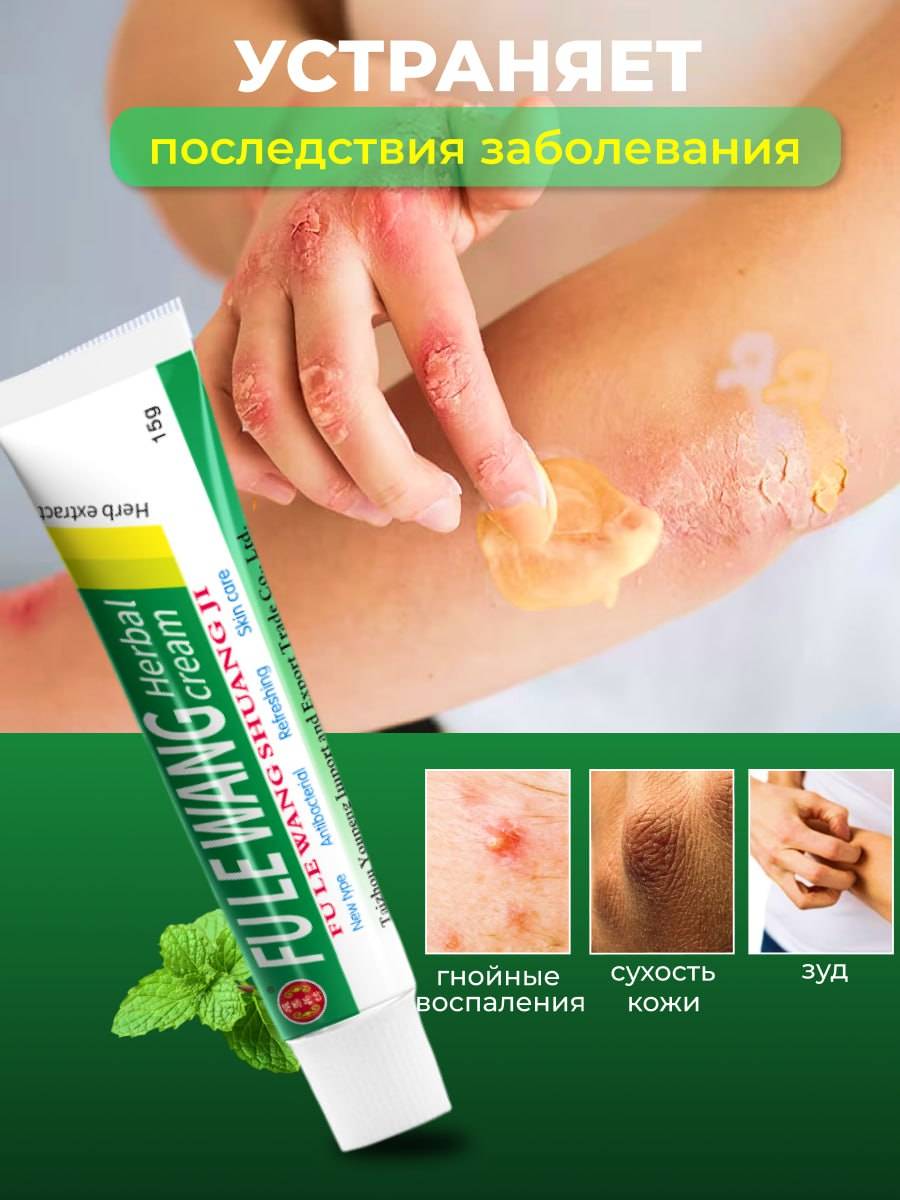 YIGANERJING Zudaifu Cream for Psoriasis, Eczema & Dermatitis – 15g Natural Skin Care #3