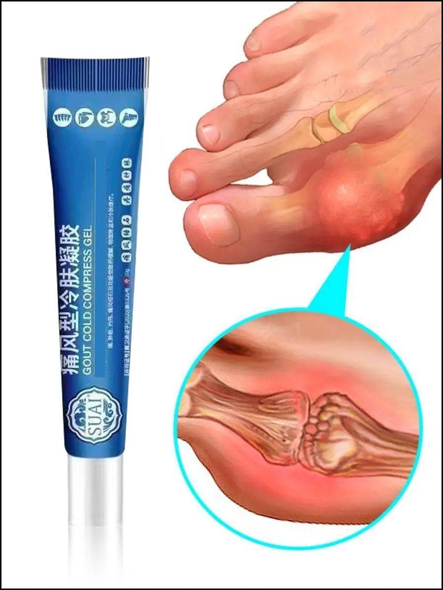 Tramps Analgesic Ointment for Gout and Arthritis, 20 g #4