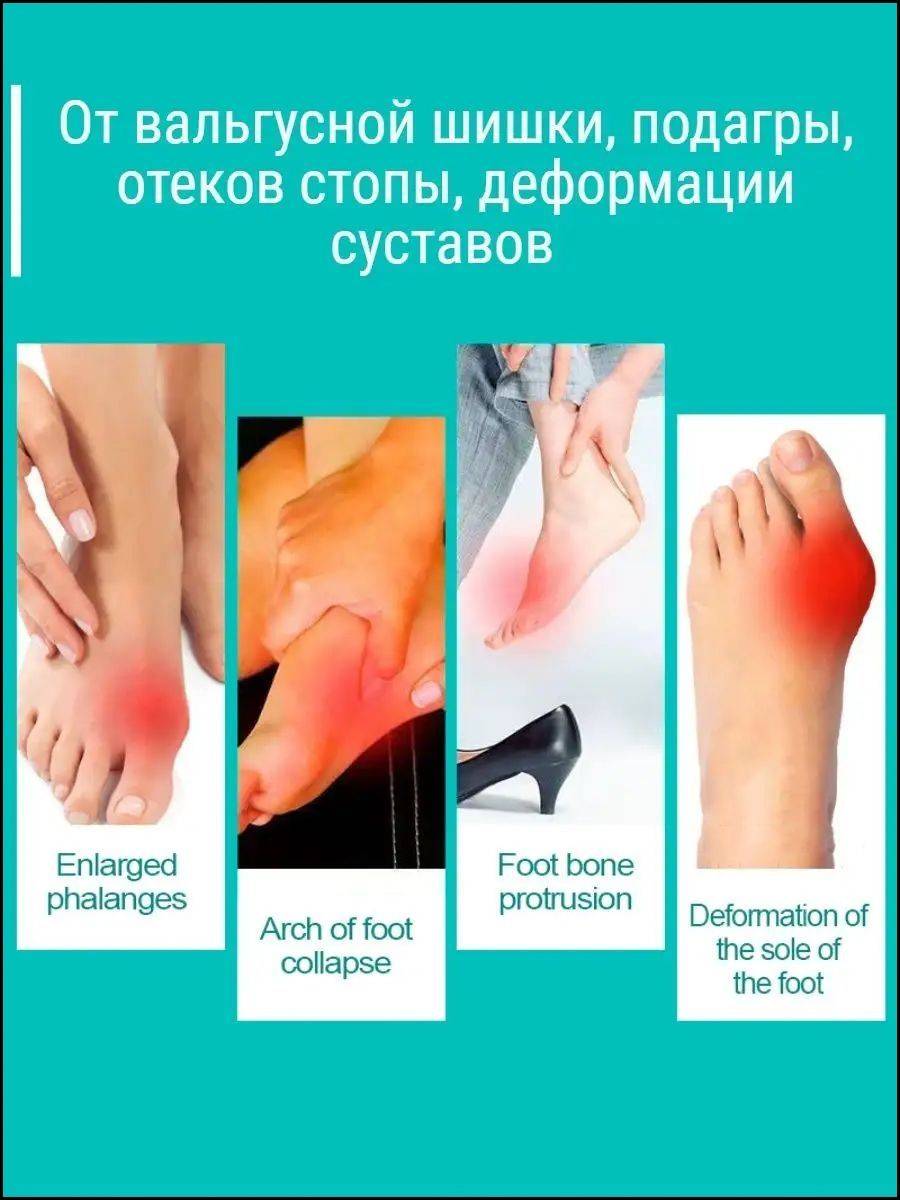 Tramps Analgesic Ointment for Gout and Arthritis, 20 g #5