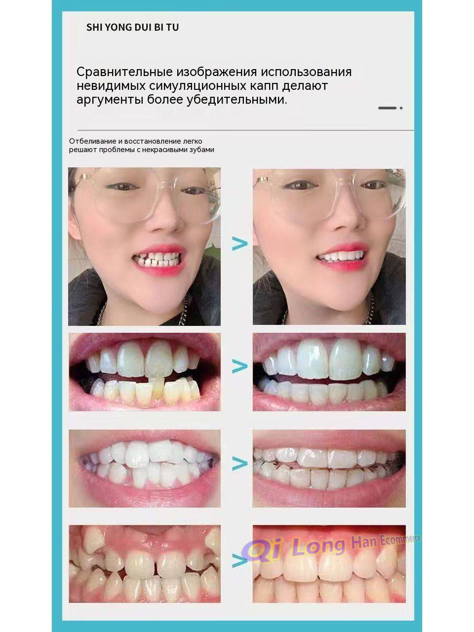 Perfect Smile Reusable Snap‑On Dental Prosthesis – Universal Adult Size #9