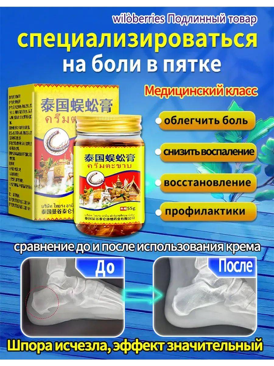Yunyue Biotech Therapeutic Agent 55 ml Yellow for Musculoskeletal System - 1 Piece #2